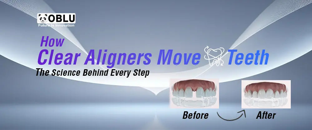 How Clear Aligners Move Teeth - Oblu