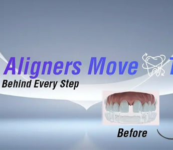 How Clear Aligners Move Teeth - Oblu