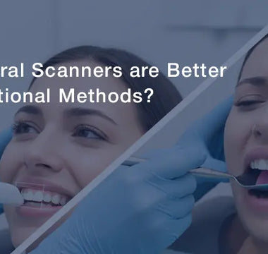 Why are Intraoral Scanners Better than Traditional Methods?- Oblu Healthcare