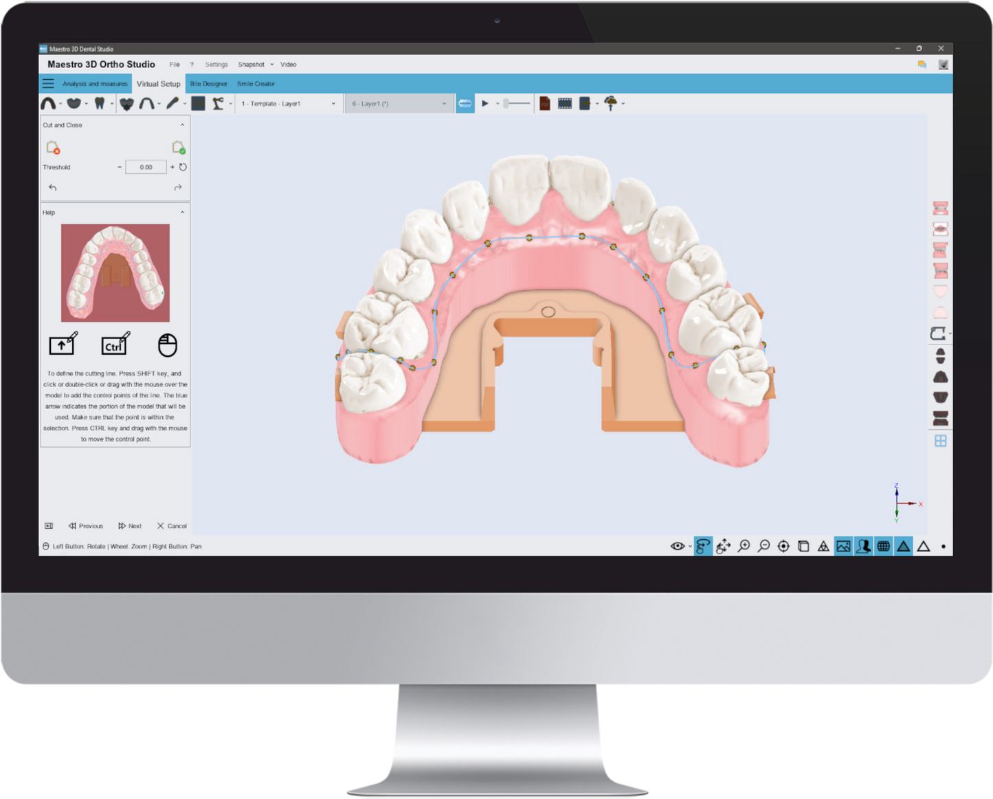 Aligner Trimming Module