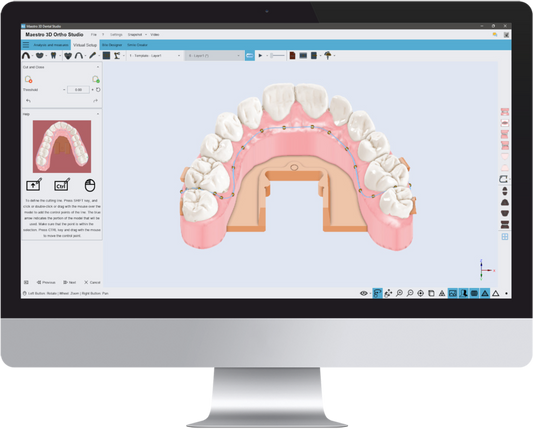 Aligner Trimming Module