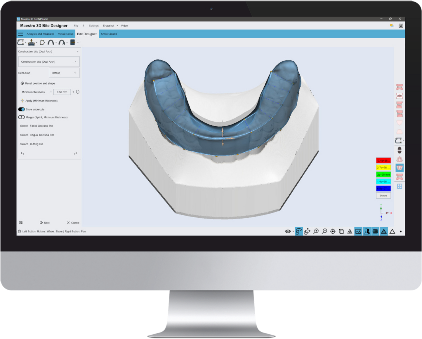 Bite Splint Software