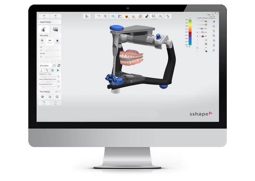 Splint Design Output 3Shape Splint Studio software and Print Custom Dental Splints – OBLU ...