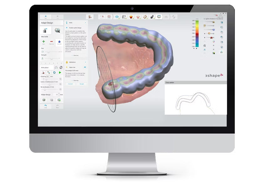 3shape Splints 3Shape Splint Studio software and Print Custom Dental Splints – OBLU ...