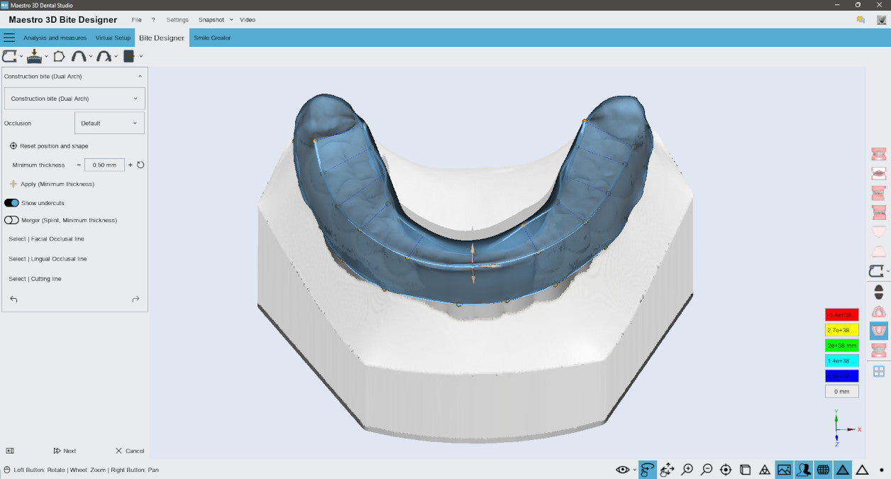 Splint Software Maestro 3D Bite Splint Software for Accurate Dental Splint Creation ...